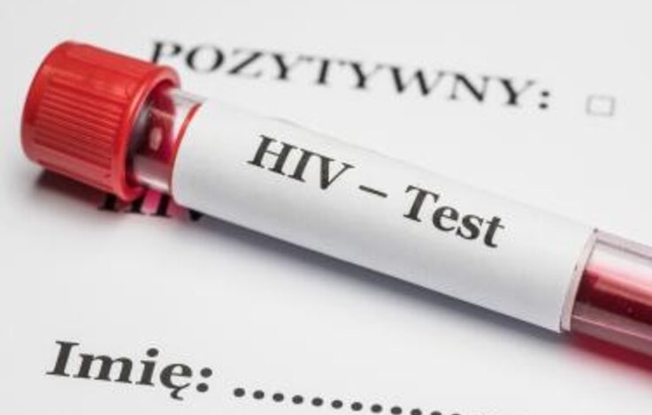  HIV: w Polsce występują niepokojące trendy