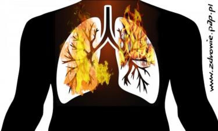  Ryzyko nowotworów u pacjentów z astmą – jakie zagrożenia niesie?