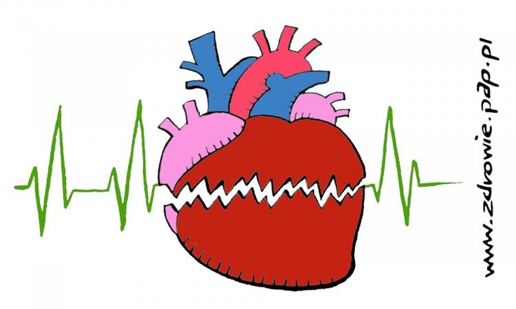  Usprawnienie systemu w celu leczenia wstrząsu kardiogennego