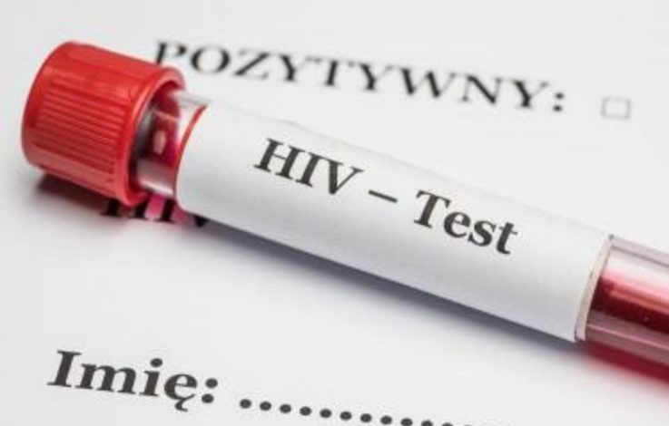  Odpowiedź na pytanie: Czy powinniśmy się bać HIV?